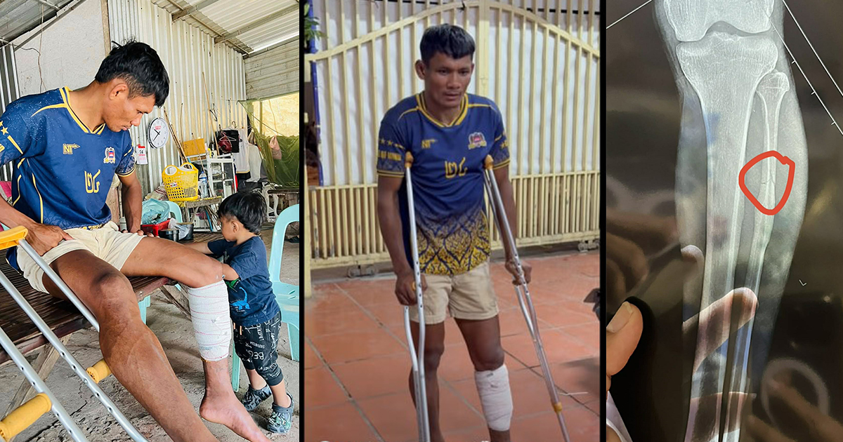 ស្ថានភាព​របួស​ ឡុង​ ប៉េងលឿន​ ត្រូវ​សម្រាក​ប្រហែល​ ៥-៦​ខែ​ និង​កំពុង​ព្យាបាល​នៅ​ផ្ទះលោក​ ម៉ាង​ ម៉ន​