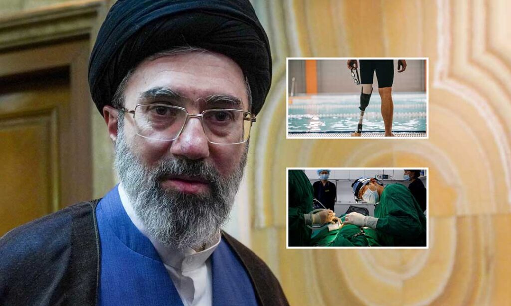 New York Times៖ មេដឹកនាំកំពូល​អ៊ីរ៉ង់ ត្រូវ​ដាក់​ជើងសិប្បនិម្មិត ហើយមុខត្រូវ​វះកាត់កែសម្ផស្ស