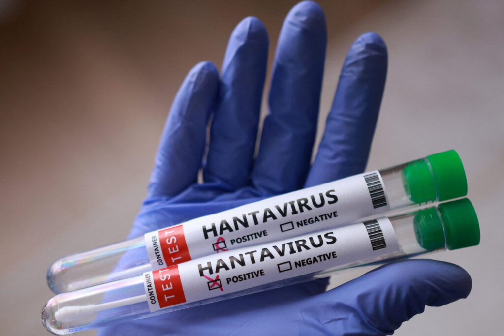 Hantavirus