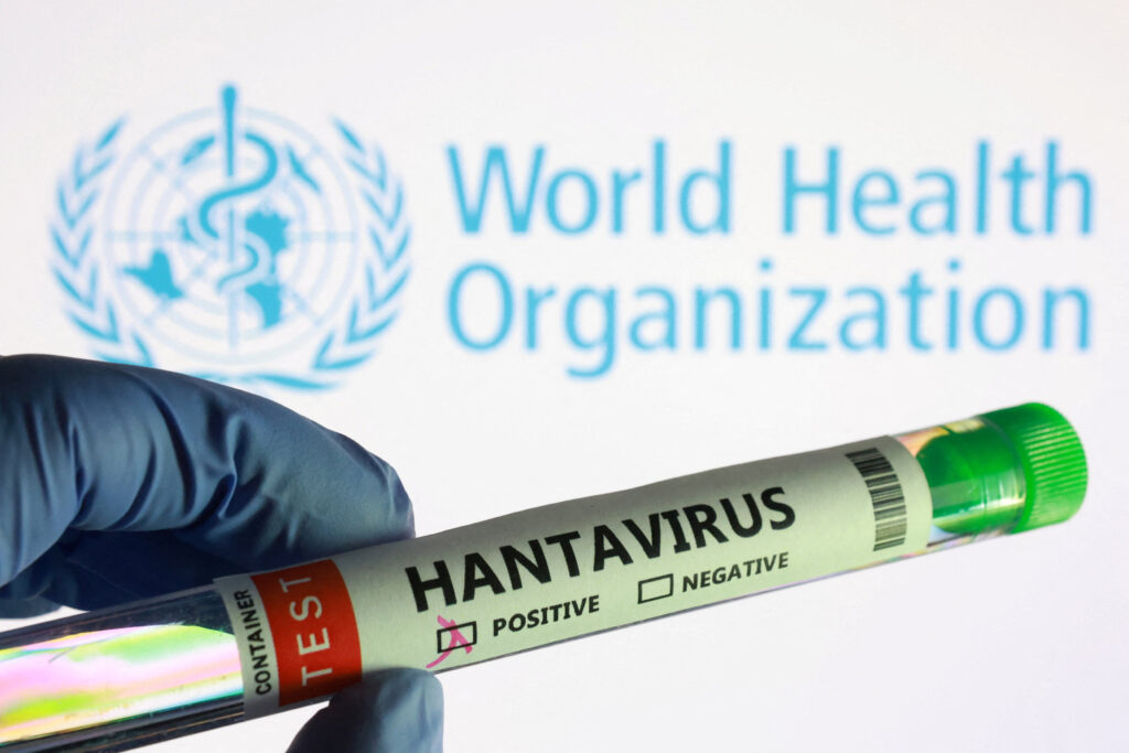Hantavirus